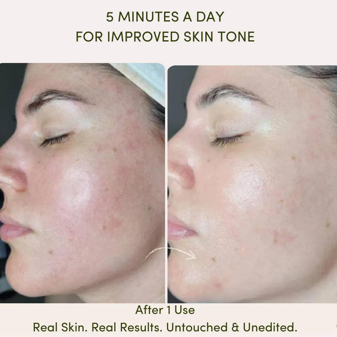 ZestDrop™ Skin Rejuvenator
