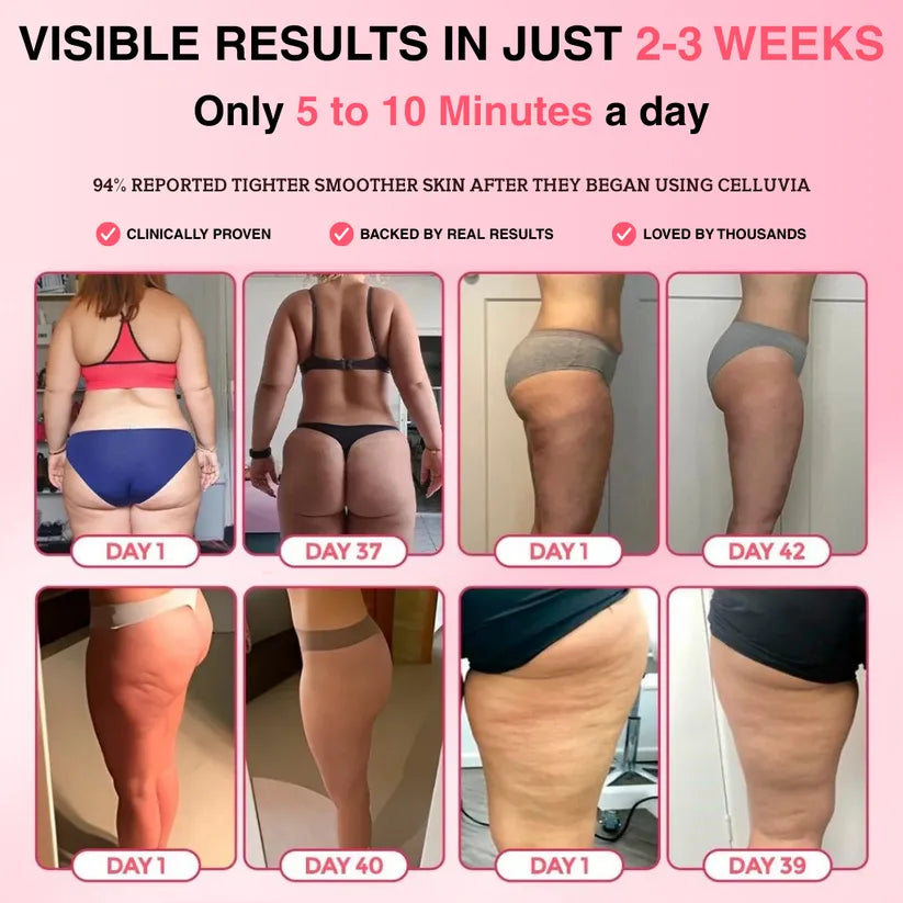 ZestDrop™ Anti Cellulite Massager