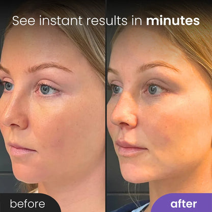 ZestDrop™ Anti-Aging Roller