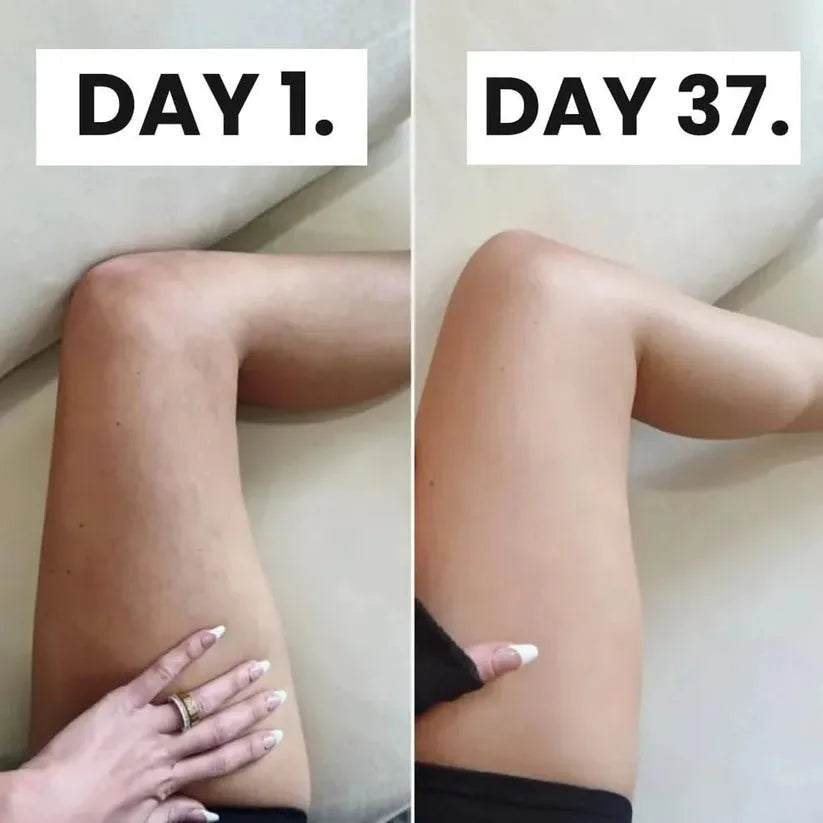 ZestDrop™ Anti Cellulite Massager